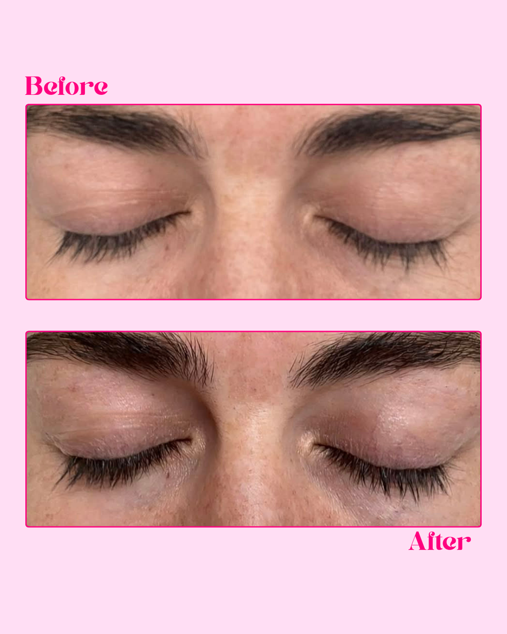 Peptide Lash Growth Serum