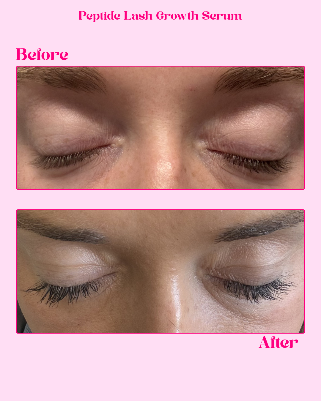 Peptide Lash Growth Serum